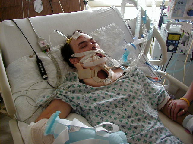 Intubated Trauma Patient