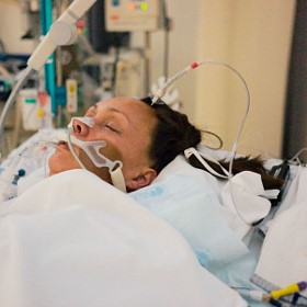 cancer ventilator lung icu coma stroke care induced stage waking intensive critical nurse hutzel patrik consultant comments november