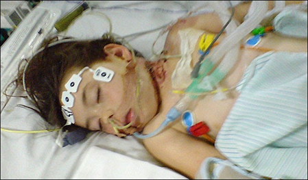 My Son is in ICU and Ventilated. Why Does the ICU Team Cannot Wean my Son Off the Ventilator?