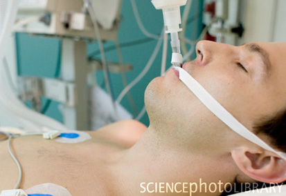 After Coming Off the Ventilator, Is There a Chance to Go Again Ventilated?