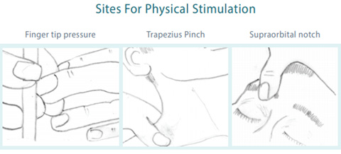 Sites for Physical Stimulation