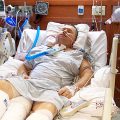 My Dad is Improving in ICU But Why Does the ICU Team Aims for Withdrawal of Treatment?