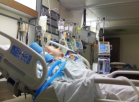 MY PARTNER WITH COVID-19 IS OFF ECMO IN ICU BUT WHY HE’S NOT WAKING UP FROM THE INDUCED COMA?