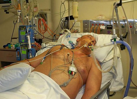 My Husband is in Coma in ICU. Can the Neurologist Best Help Him Improve His Condition?