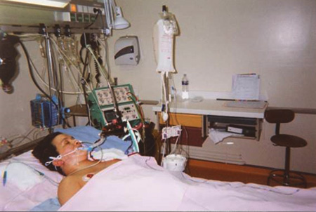 My Mom is Critically Ill in ICU and the ICU Team Wants to Withdraw Treatment. What Should I do? Help!