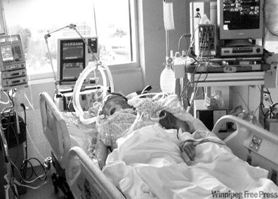 What Would Be My Sister’s Quality of Life After Being on a Ventilator in ICU?